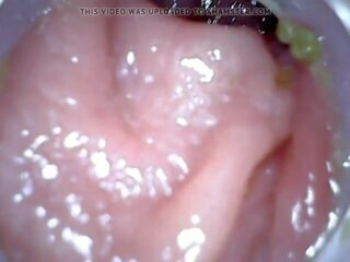 肛門 endoscope 部分 1, 免費 灌腸劑 懲罰 高清晰度 臟 電影 04